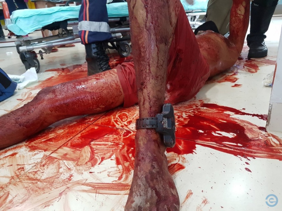 Imagens fortes: Execução em Coxim mata jovem e fere outro