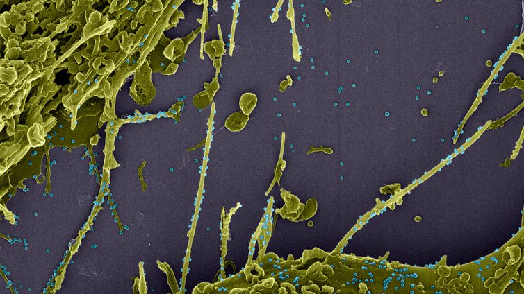 Estudo constata infecção simultânea por duas linhagens do coronavírus © LMMV/IOC/Fiocruz