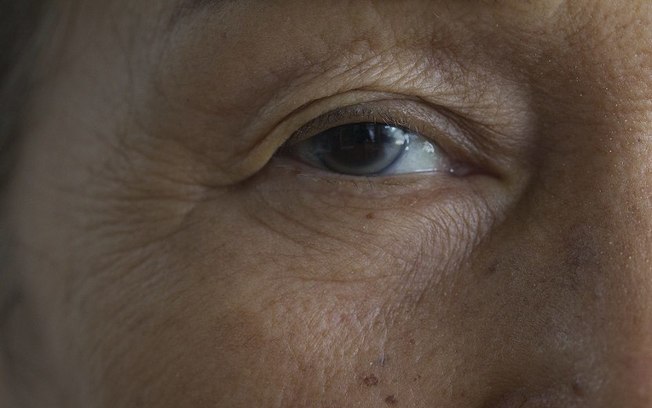 Como acontece a flacidez das pálpebras? Conheça um procedimento rejuvenescedor Como acontece a flacidez das pálpebras? Conheça um procedimento rejuvenescedor