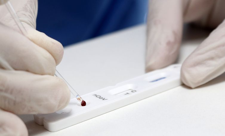 Covid-19: Brasil registra 58,4 mil casos e 1,2 mil mortes, em 24 horas © Mauricio Vieira/Secom-SC