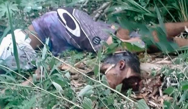 Imagem forte: jovem é encontrado decapitado e com sinais de tiros O corpo foi levado para o Instituto de Medicina e Odontologia Legal e a Polícia Civil investiga o caso (Reprodução/Capital do Pantanal)