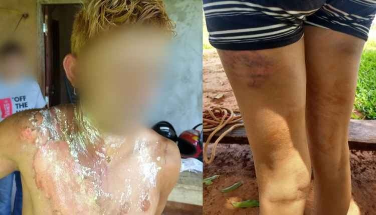 Mulher sequestrada e estuprada pelo ex queima homem para se livrar de torturas Mulher sequestrada e estuprada pelo ex queima homem para se livrar de torturas