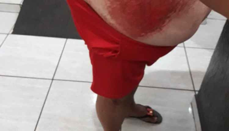 Passou com o carro por cima de mulher por causa de dívida de R$ 1 mil Foto: Olimar Gamarra