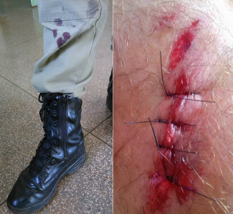 O agente ferido foi socorrido e encaminhado para atendimento médico no hospital Municipal, sendo que o mesmo apresentava lesões na perna e no joelho.