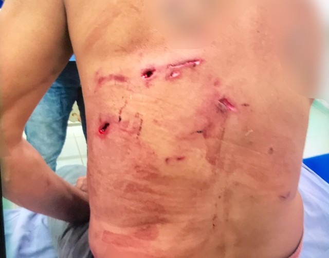 Homem atacado por onça-pintada é salvo por 5 cachorros em MS Homem é salvo por cães ao ser atacado por onça em fazenda de Porto Murtinho (MS). — Foto: Divulgação/Corpo de Bombeiro
