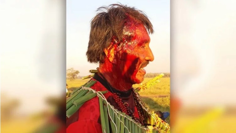 ‘Ordem de Brasília’: 130 PMs de MS expulsaram indígenas de fazenda sem mandado Indígenas com ferimento na cabeça após disparo de bala de borracha | Foto: Divulgação/WhatsApp