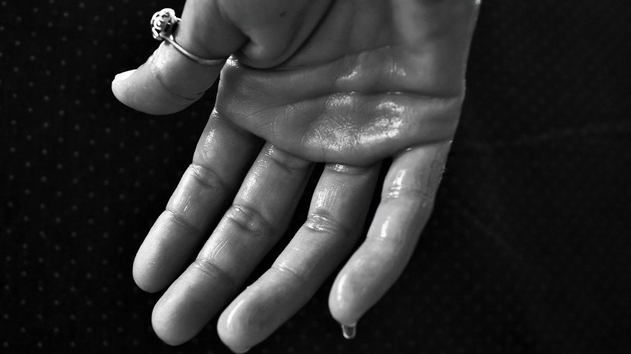 Hiperidrose: quando o excesso de suor pode ser uma condição médica