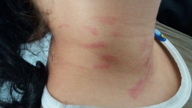 Grávida é agredida por amante do marido ao ver os dois na cama em Campo Grande Grávida conseguiu fugir e pedir ajuda a irmã (Ilustrativa)